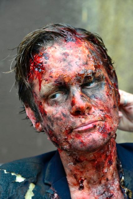 ExplosionsBrandopfer 